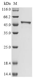 Recombinant Severe acute respiratory syndrome coronavirus 2 Nucleoprotein (N) (S202N) (Active)