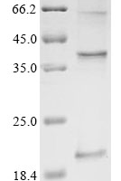 (Tris-Glycine gel) Discontinuous SDS-PAGE (reduced) with 5% enrichment gel and 15% separation gel.
