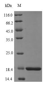 Recombinant Severe acute respiratory syndrome coronavirus 2 Nucleoprotein (N), partial