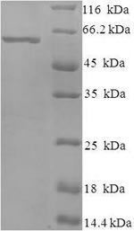 Recombinant Bovine respiratory syncytial virus Nucleoprotein (N)