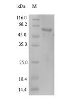 Recombinant Newcastle disease virus Nucleoprotein (N)