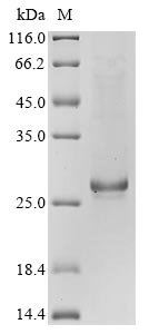 Recombinant Bovine coronavirus Protein I (N)
