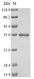 Recombinant Hepatitis delta virus genotype I Large delta antigen