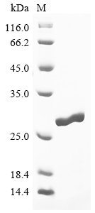 Recombinant Fasciola hepatica Cathepsin L2, partial