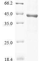 (Tris-Glycine gel) Discontinuous SDS-PAGE (reduced) with 5% enrichment gel and 15% separation gel.