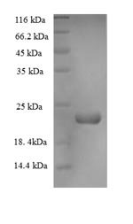 Recombinant Dactylis glomerata Major pollen allergen Dac g 4, partial