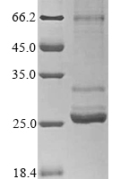(Tris-Glycine gel) Discontinuous SDS-PAGE (reduced) with 5% enrichment gel and 15% separation gel.