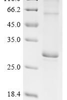 (Tris-Glycine gel) Discontinuous SDS-PAGE (reduced) with 5% enrichment gel and 15% separation gel.