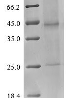 (Tris-Glycine gel) Discontinuous SDS-PAGE (reduced) with 5% enrichment gel and 15% separation gel.