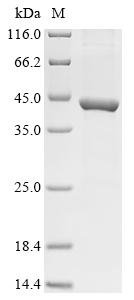 Recombinant Human rhinovirus 1B Genome polyprotein, partial, Human rhinovirus 1B (HRV-1B), E.coli, N-terminal 10xHis-tagged and C-terminal Myc-tagged, 43.9kDa, purity >85% as determined by SDS-PAGE.