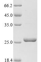 (Tris-Glycine gel) Discontinuous SDS-PAGE (reduced) with 5% enrichment gel and 15% separation gel.