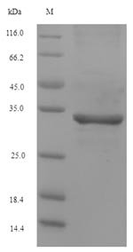 Recombinant Ascaris suum Major pepsin inhibitor 3