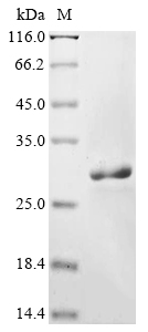 Recombinant BK polyomavirus Small t antigen, BK polyomavirus (strain AS) (BKPyV), E.coli, N-terminal 10xHis-tagged and C-terminal Myc-tagged, 27.9kDa, purity >90% as determined by SDS-PAGE.