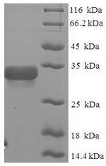Recombinant Glycine max 2S seed storage albumin protein