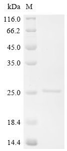 Recombinant Macaca fascicularis Hemoglobin subunit alpha-A/Q/R/T