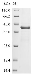 Recombinant Murine polyomavirus Major capsid protein VP1