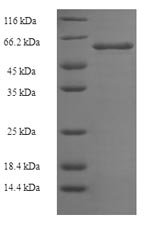 Recombinant Clostridium butyricum Botulinum neurotoxin type E, partial, Clostridium butyricum, E.coli, N-terminal 6xHis-SUMO-tagged, 63.7kDa, purity >90% as determined by SDS-PAGE.