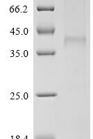 (Tris-Glycine gel) Discontinuous SDS-PAGE (reduced) with 5% enrichment gel and 15% separation gel.