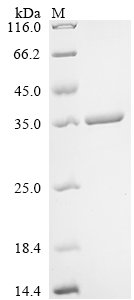 Recombinant Penicillium citrinum Nuclease P1