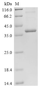 Recombinant Human STEAP1 protein (STEAP1) Protein, Homo sapiens (Human), in vitro E.coli expression system, C-terminal 10xHis-tagged, 41.2kDa, purity >85% as determined by SDS-PAGE.