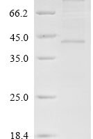 (Tris-Glycine gel) Discontinuous SDS-PAGE (reduced) with 5% enrichment gel and 15% separation gel.