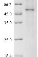 (Tris-Glycine gel) Discontinuous SDS-PAGE (reduced) with 5% enrichment gel and 15% separation gel.