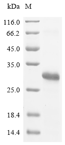 Recombinant JC polyomavirus Small t antigen