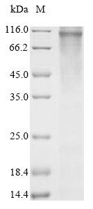 Recombinant Human Wolframin (WFS1) Protein, Homo sapiens (Human), in vitro E.coli expression system, N-terminal 10xHis-tagged, 106.3kDa, purity >85% as determined by SDS-PAGE.