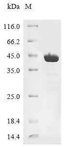 Recombinant JC polyomavirus Minor capsid protein VP2