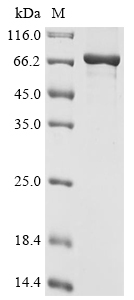 Recombinant St. louis encephalitis virus Genome polyprotein, partial, St.louis encephalitis virus (strain MS1-7), E.coli, N-terminal 10xHis-tagged, 74.6kDa, purity >90% as determined by SDS-PAGE.