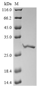 Recombinant Trichosanthes kirilowii Ribosome-inactivating protein alpha-trichosanthin