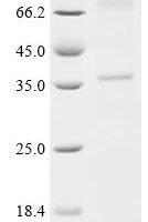 (Tris-Glycine gel) Discontinuous SDS-PAGE (reduced) with 5% enrichment gel and 15% separation gel.