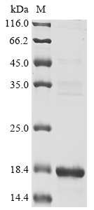 Recombinant Plasmodium falciparum Circumsporozoite protein, partial