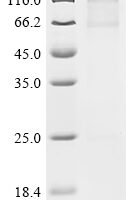 (Tris-Glycine gel) Discontinuous SDS-PAGE (reduced) with 5% enrichment gel and 15% separation gel.