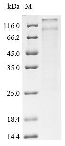 Recombinant Rabbit Potassium voltage-gated channel subfamily KQT member 1 (KCNQ1) (X15W) Protein, Oryctolagus cuniculus (Rabbit), in vitro E.coli expression system, N-terminal 10xHis-tagged, 79.8kDa, purity >85% as determined by SDS-PAGE.