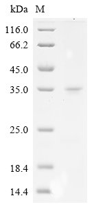 Recombinant Ricinus communis Ricin, partial