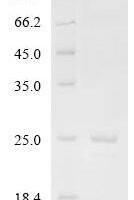 (Tris-Glycine gel) Discontinuous SDS-PAGE (reduced) with 5% enrichment gel and 15% separation gel.
