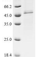 (Tris-Glycine gel) Discontinuous SDS-PAGE (reduced) with 5% enrichment gel and 15% separation gel.