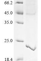 (Tris-Glycine gel) Discontinuous SDS-PAGE (reduced) with 5% enrichment gel and 15% separation gel.