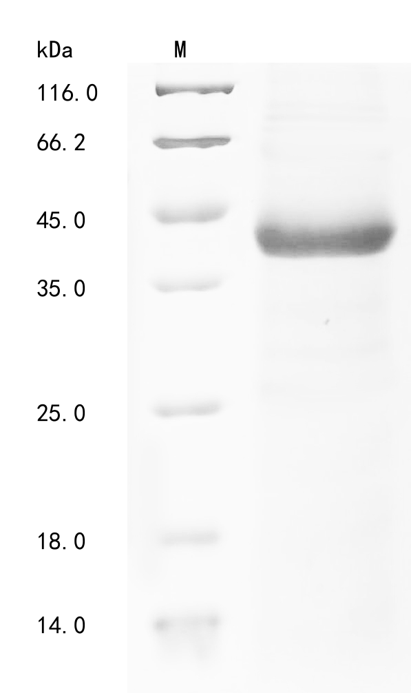 Recombinant Human parechovirus 1 Genome polyprotein, partial, Human parechovirus 1 (strain Harris) (HPeV-1) (Echovirus 22), E.coli, N-terminal 10xHis-tagged and C-terminal Myc-tagged, 39.1kDa, purity >85% as determined by SDS-PAGE.
