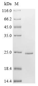 Recombinant Human Caveolin-1 (CAV1) Protein, Homo sapiens (Human), in vitro E.coli expression system, N-terminal 10xHis-tagged, 22kDa, purity >90% as determined by SDS-PAGE.