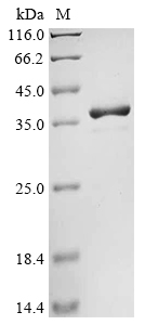 Recombinant Sesamum indicum 11S globulin seed storage protein 2, partial