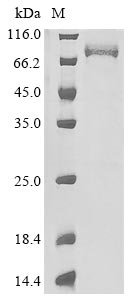Recombinant Paeniclostridium sordellii Sialidase