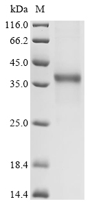 Recombinant Dendroaspis polylepis polylepis Kunitz-type serine protease inhibitor dendrotoxin E