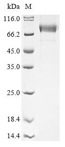 Recombinant Orthohantavirus hantanense Envelopment polyprotein, partial