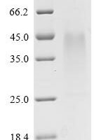 (Tris-Glycine gel) Discontinuous SDS-PAGE (reduced) with 5% enrichment gel and 15% separation gel.