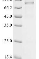 (Tris-Glycine gel) Discontinuous SDS-PAGE (reduced) with 5% enrichment gel and 15% separation gel.