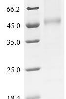 (Tris-Glycine gel) Discontinuous SDS-PAGE (reduced) with 5% enrichment gel and 15% separation gel.