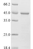 (Tris-Glycine gel) Discontinuous SDS-PAGE (reduced) with 5% enrichment gel and 15% separation gel.