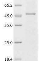 (Tris-Glycine gel) Discontinuous SDS-PAGE (reduced) with 5% enrichment gel and 15% separation gel.